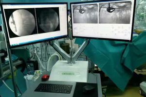 China approves ‘robot doctor’ for orthopaedic surgery