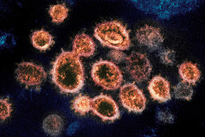 UN Agency Sounds Warning on Rise in Avian Flu Cases